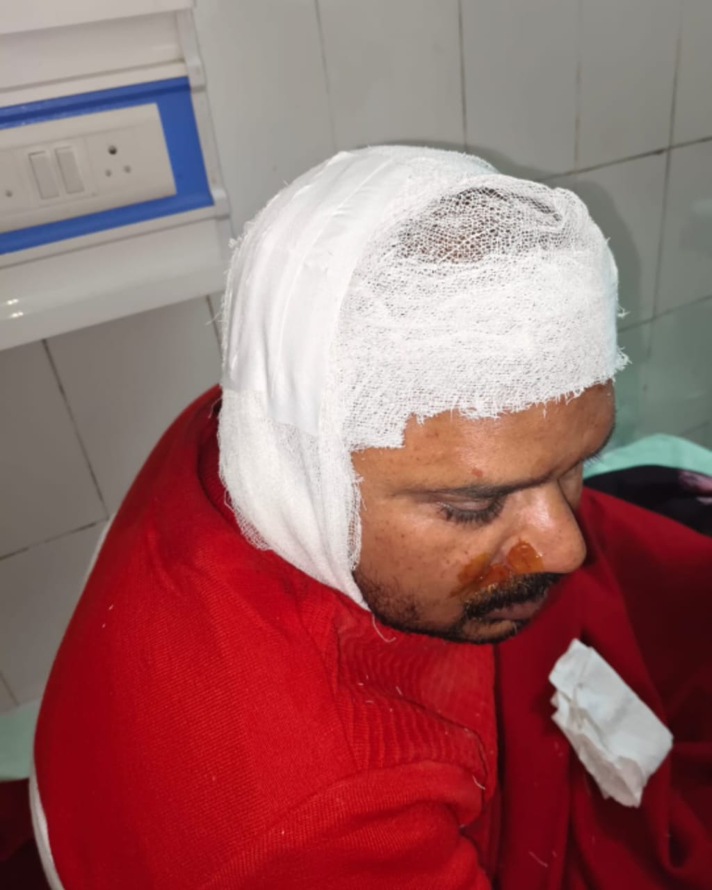 बुंदेलखंड विधि कॉलेज के छात्र पर जानलेवा हमला, सिर में लगे 15–20 टांके