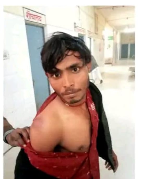 दबंगों ने चार शिकारियों को पीटकर किया घायल, धारदार हथियारों का इस्तेमाल