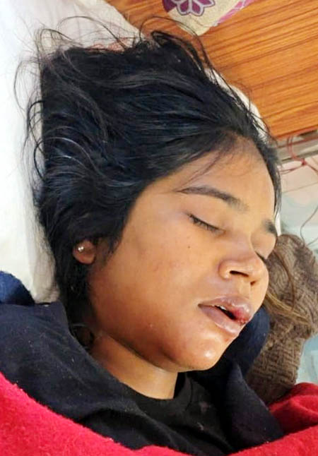 ससुराल आए युवक ने पत्नी को पीटा – जिला अस्पताल रेफर, पुलिस गिरफ्त में आरोपी