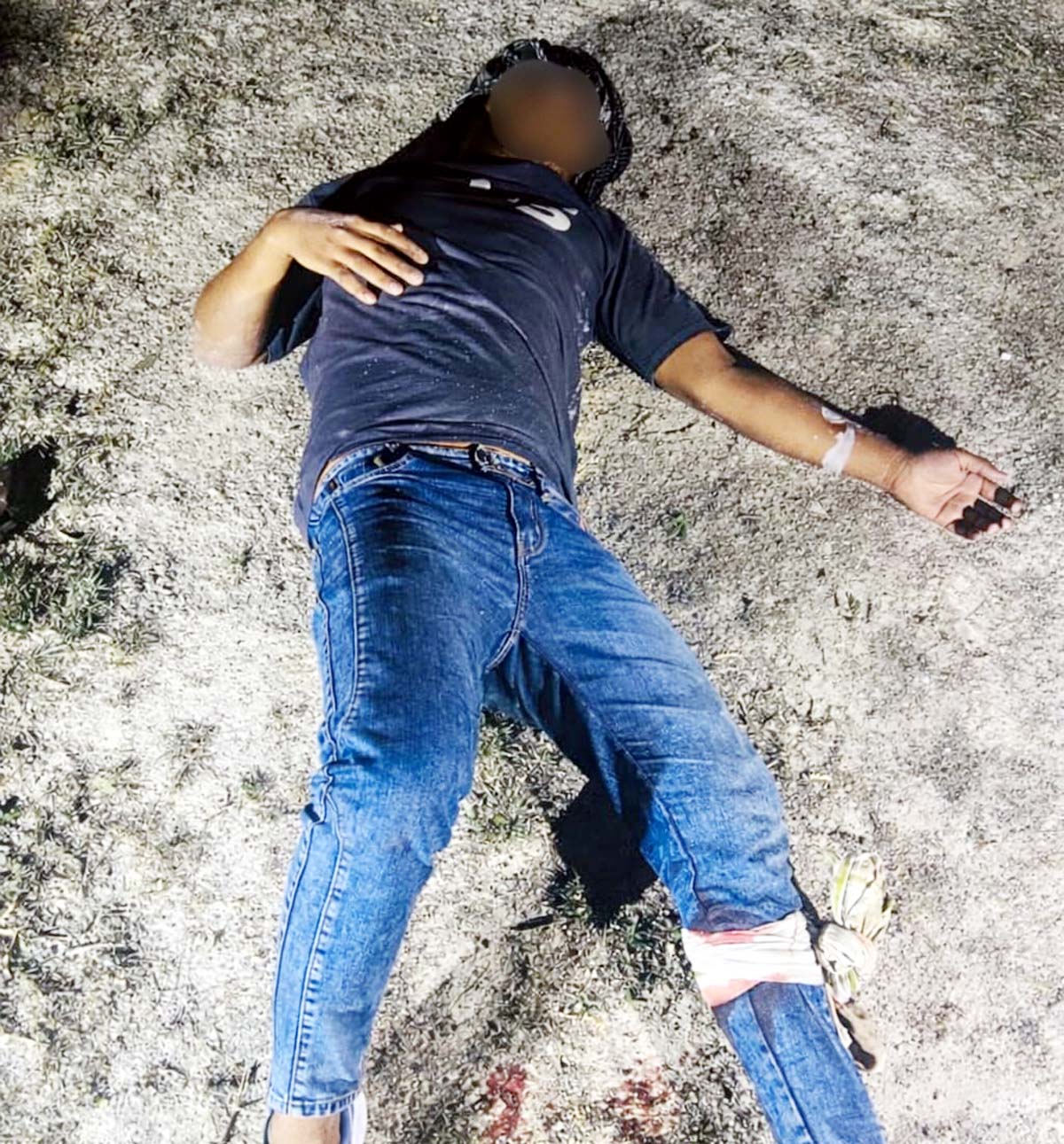 पुलिस मुठभेड़ में 25 हजार रुपए का इनामिया गैंगस्टर घायल